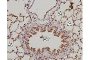 Expression of Adenosine A2B Receptor in rat lung - Immunohistochemical staining of rat lung paraffin embedded sections using Anti-Adenosine A2B Receptor (extracellular) Antibody (ABIN7042889, ABIN7043890 and ABIN7043891), (1:50). (Adenosine A2b Receptor antibody  (2nd Extracellular Loop, Cys154))