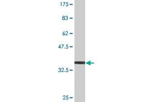 MLKL antibody  (AA 371-471)