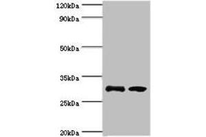 Western blot All lanes: RPA4 antibody at 3 μg/mL Lane 1: K562 whole cell lysate Lane 2: Mouse spleen tissue Secondary Goat polyclonal to rabbit IgG at 1/10000 dilution Predicted band size: 29 kDa Observed band size: 29 kDa (RPA4 antibody  (AA 1-230))