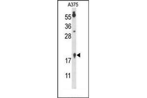 Western blot analysis of FAM96B Antibody (N-term) in A375 cell line lysates (35ug/lane). (FAM96B antibody  (C-Term, N-Term))
