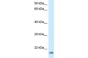 WB Suggested Anti-RPL23A Antibody Titration: 1.