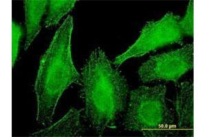 Immunofluorescence of monoclonal antibody to DST on HeLa cell. (Dystonin antibody  (AA 401-500))