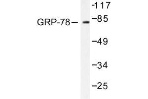 Image no. 1 for anti-Heat Shock 70kDa Protein 5 (Glucose-Regulated Protein, 78kDa) (HSPA5) antibody (ABIN265447) (GRP78 antibody)