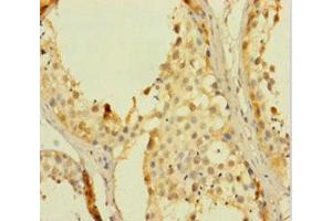 Immunohistochemistry of paraffin-embedded human testis tissue using ABIN7168079 at dilution of 1:100 (RHOXF2 antibody  (AA 1-244))