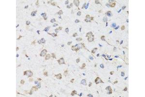 Immunohistochemistry of paraffin-embedded Mouse brain using USP25 Polyclonal Antibody at dilution of 1:100 (40x lens). (USP25 antibody)