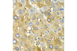 Immunohistochemistry of paraffin-embedded human liver injury using CHIA antibody (ABIN5971776) at dilution of 1/100 (40x lens). (CHIA antibody)
