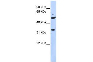 WB Suggested Anti-ZFP36L2 Antibody Titration:  0. (ZFP36L2 antibody  (N-Term))