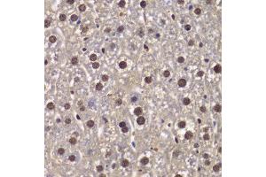 Immunohistochemistry of paraffin-embedded mouse liver using SMARCB1 antibody at dilution of 1:200 (400x lens). (SMARCB1 antibody)