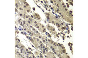 Immunohistochemistry of paraffin-embedded human stomach using SUB1 antibody (ABIN5974252) at dilution of 1/100 (40x lens). (SUB1 antibody)