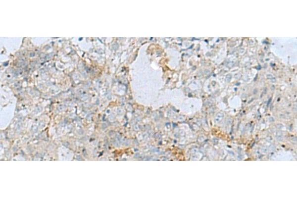 NAGK antibody