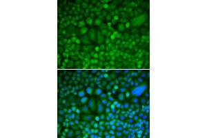 Immunofluorescence (IF) image for anti-Cyclin H (CCNH) (AA 1-323) antibody (ABIN3021259)