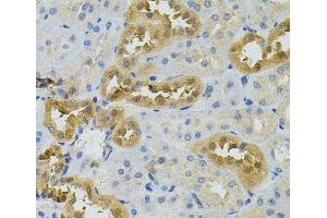 Immunohistochemistry of paraffin-embedded Rat kidney using NAT8 Polyclonal Antibody (NAT8 antibody)