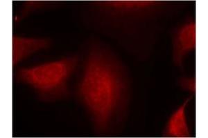 Image no. 1 for anti-Mdm2, p53 E3 Ubiquitin Protein Ligase Homolog (Mouse) (MDM2) (Ser166) antibody (ABIN319418) (MDM2 antibody  (Ser166))