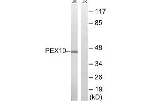 Western blot analysis of extracts from Jurkat cells, using PEX10 antibody. (PEX10 antibody  (Internal Region))