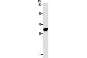 Western Blotting (WB) image for anti-Internexin Neuronal Intermediate Filament Protein, alpha (INA) antibody (ABIN2426549) (INA antibody)