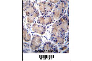 CES8 Antibody immunohistochemistry analysis in formalin fixed and paraffin embedded human stomach tissue followed by peroxidase conjugation of the secondary antibody and DAB staining. (CES4A antibody  (C-Term))