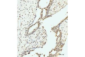 IHC analysis of AKAP 95/AKAP8 using anti-AKAP 95/AKAP8 antibody (ABIN7601553). (AKAP8 antibody  (AA 380-546))