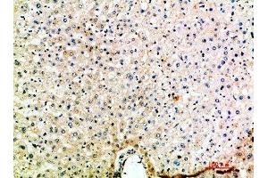 Immunohistochemical analysis of paraffin-embedded human-liver, antibody was diluted at 1:200 (CCL15 antibody  (AA 51-100))