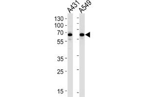 Western Blotting (WB) image for anti-Stress-Induced-phosphoprotein 1 (STIP1) antibody (ABIN3001649) (STIP1 antibody)