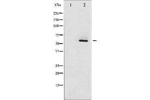 Western blot analysis of Estrogen Receptor- beta phosphorylation expression in HepG2 whole cell lysates,The lane on the left is treated with the antigen-specific peptide. (ESR2 antibody  (pSer105))