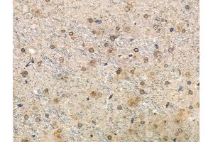 Phospho-Tau (Thr492/Thr175) Antibody at 1/100 staining Rat brain tissue by IHC-P. (MAPT antibody  (pThr175, pThr492))