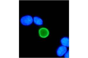 IF analysis of HPV-11 E7 protein in U2OS cells. (Human Papilloma Virus 11 E7 (HPV-11 E7) (AA 1-35) antibody)