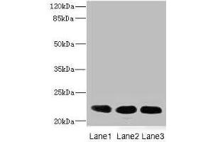Western blot All lanes: CRIP2 antibody at 4. (CRIP2 antibody  (AA 1-208))