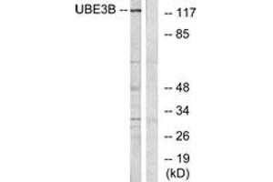Western blot analysis of extracts from Jurkat cells, using UBE3B Antibody. (UBE3B antibody  (AA 581-630))