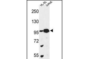 Western blot analysis of CS Antibody (N-term) (ABIN653334 and ABIN2842822) in HL-60, Jurkat cell line lysates (35 μg/lane). (CSPP1 antibody  (N-Term))