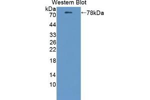 Detection of Recombinant ATP2B2, Mouse using Polyclonal Antibody to ATPase, Ca++ Transporting, Plasma Membrane 2 (ATP2B2) (ATP2B2 antibody  (AA 417-830))