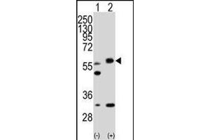 Western blot analysis of STK11 (arrow) using rabbit polyclonal STK11 Antibody (ABIN391350 and ABIN2841371).