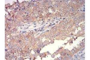 Immunohistochemistry (IHC) image for anti-Wingless-Type MMTV Integration Site Family, Member 3A (WNT3A) (AA 170-352) antibody (ABIN5906379) (WNT3A antibody  (AA 170-352))