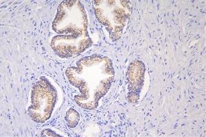 IHC analysis of DSG2 using anti-DSG2 antibody (ABIN7600803). (Desmoglein 2 antibody  (AA 24-1020))