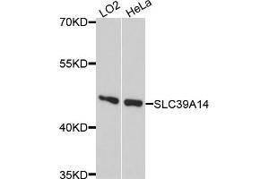 Western blot analysis of extracts of various cell lines, using SLC39A14 antibody. (SLC39A14 antibody)