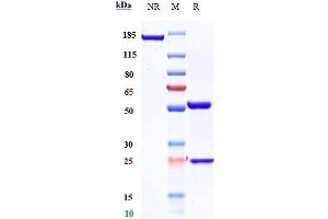 Anti-CXCR4 / CD184 Reference Antibody (ulocuplumab) on SDS-PAGE under reducing (R) condition. (Recombinant CXCR4 (Ulocuplumab Biosimilar) antibody)
