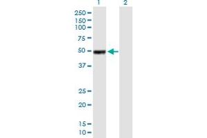Western Blotting (WB) image for anti-Immunoglobulin Heavy Constant gamma 1 (G1m Marker) (IGHG1) (AA 1-469) antibody (ABIN516955)