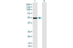 Western Blot analysis of IGHG1 expression in transfected 293T cell line by IGHG1 MaxPab polyclonal antibody. (IGHG1 antibody  (AA 1-469))