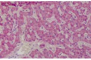 Human Liver: Formalin-Fixed, Paraffin-Embedded (FFPE) (GSTM1 antibody  (AA 1-159))