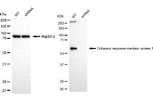 Western blotting analysis using collapsin response mediator protein 1 antibody (ABIN7798129).