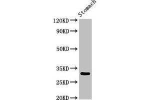 Western Blot Positive WB detected in: Rat stomach tissue All lanes: GCLM antibody at 3 μg/mL Secondary Goat polyclonal to rabbit IgG at 1/50000 dilution Predicted band size: 31, 29 kDa Observed band size: 31 kDa (GCLM antibody  (Regulatory Subunit))