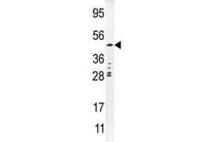 PLAU antibody  (AA 396-426)