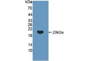 Detection of Recombinant IkBa, Human using Polyclonal Antibody to Inhibitory Subunit Of NF Kappa B Alpha (IkBa) (Inhibitory Subunit Of NF kappa B alpha (AA 74-247) antibody)