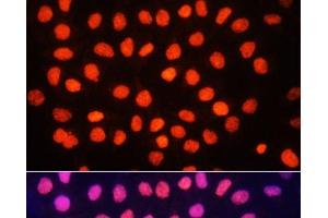 Immunofluorescence analysis of HeLa cells using TriMethyl-Histone H3-K64 Polyclonal Antibody at dilution of 1:100. (Histone 3 antibody  (3meLys64))