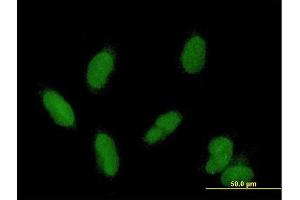 Immunofluorescence of purified MaxPab antibody to CDK2AP1 on HepG2 cell. (CDK2AP1 antibody  (AA 1-115))