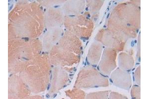 DAB staining on IHC-P; Samples: Mouse Skeletal muscle Tissue (MYLK2 antibody  (AA 330-548))