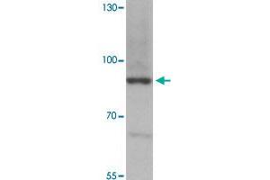 Western blot analysis of MEX3B in mouse skeletal muscle tissue with MEX3B polyclonal antibody  at 1 ug/mL. (MEX3B antibody  (Internal Region))