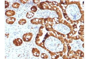 Formalin-fixed, paraffin-embedded human Small Intestine stained with SULT1E1 Mouse Monoclonal Antibody (CPTC-SULT1E1-1). (SULT1E1 antibody)