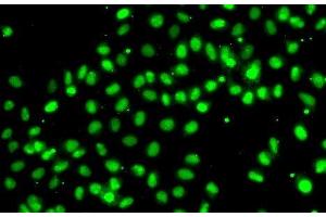 Immunofluorescence analysis of A549 cells using MEPCE Polyclonal Antibody (MEPCE antibody)