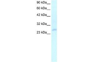 WB Suggested Anti-HOXC4 Antibody Titration:  2. (HOXC4 antibody  (N-Term))