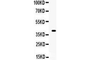 Western Blotting (WB) image for anti-Wingless-Type MMTV Integration Site Family, Member 1 (WNT1) (AA 45-74), (N-Term) antibody (ABIN3042350)